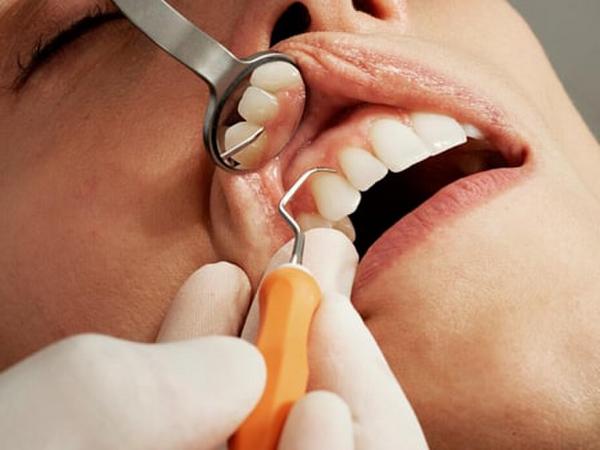 Лікування та видалення кісти зуба photo