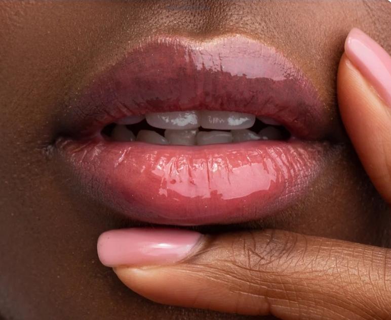 Косметологія, контурна пластика губ. фото 5