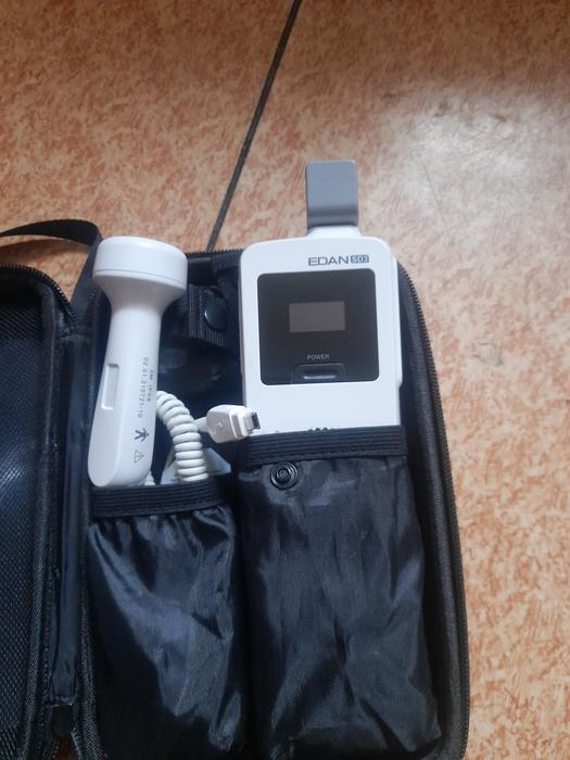 Ультрозвуковое портативное УЗИ для беременных фото 1