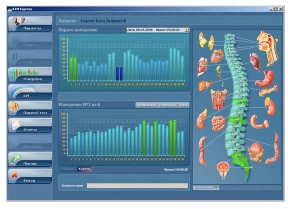 Апарат біорезонансної діагностики photo 2